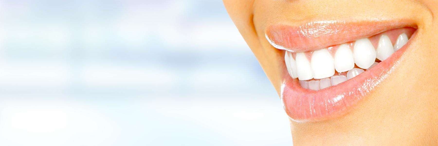 Smile Makeovers | Dentist